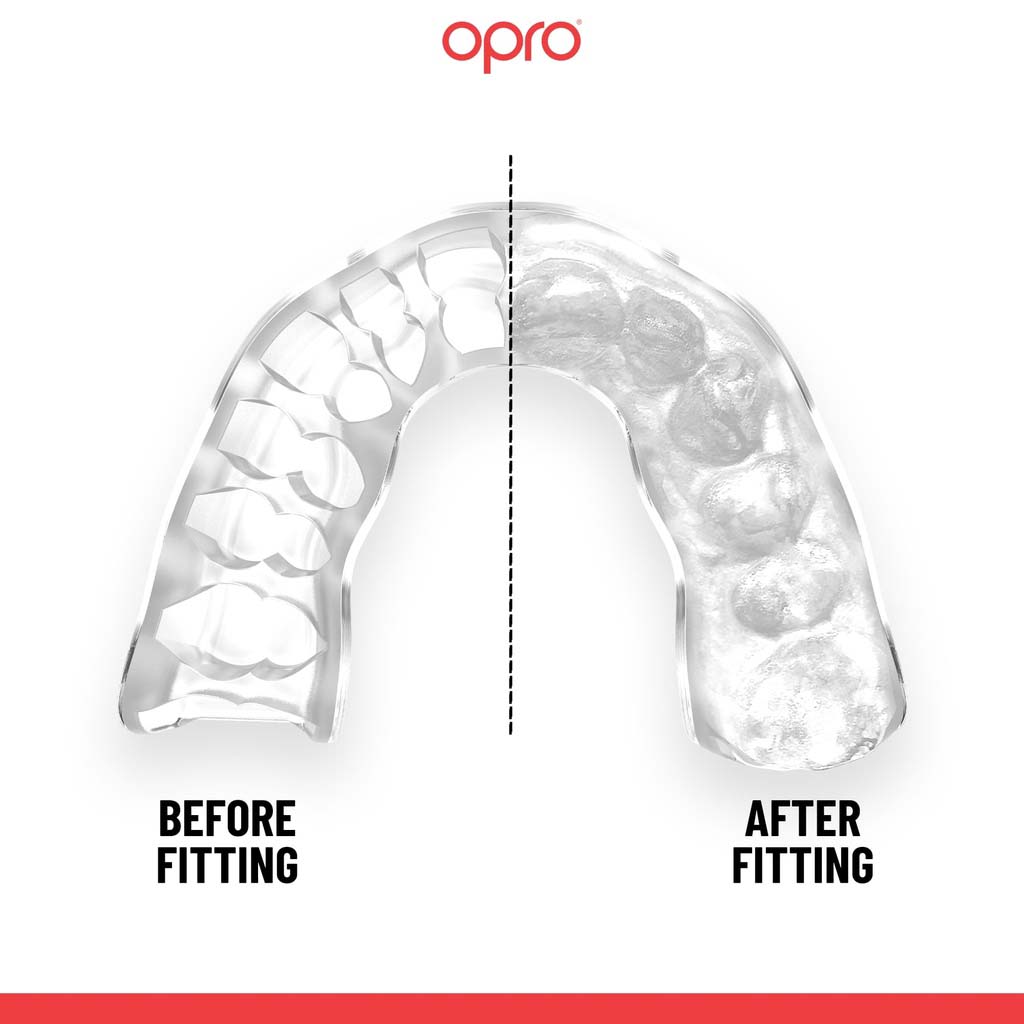 OPRO Instant Custom Snap-Fit Junior Mouth Guards - Black/White
